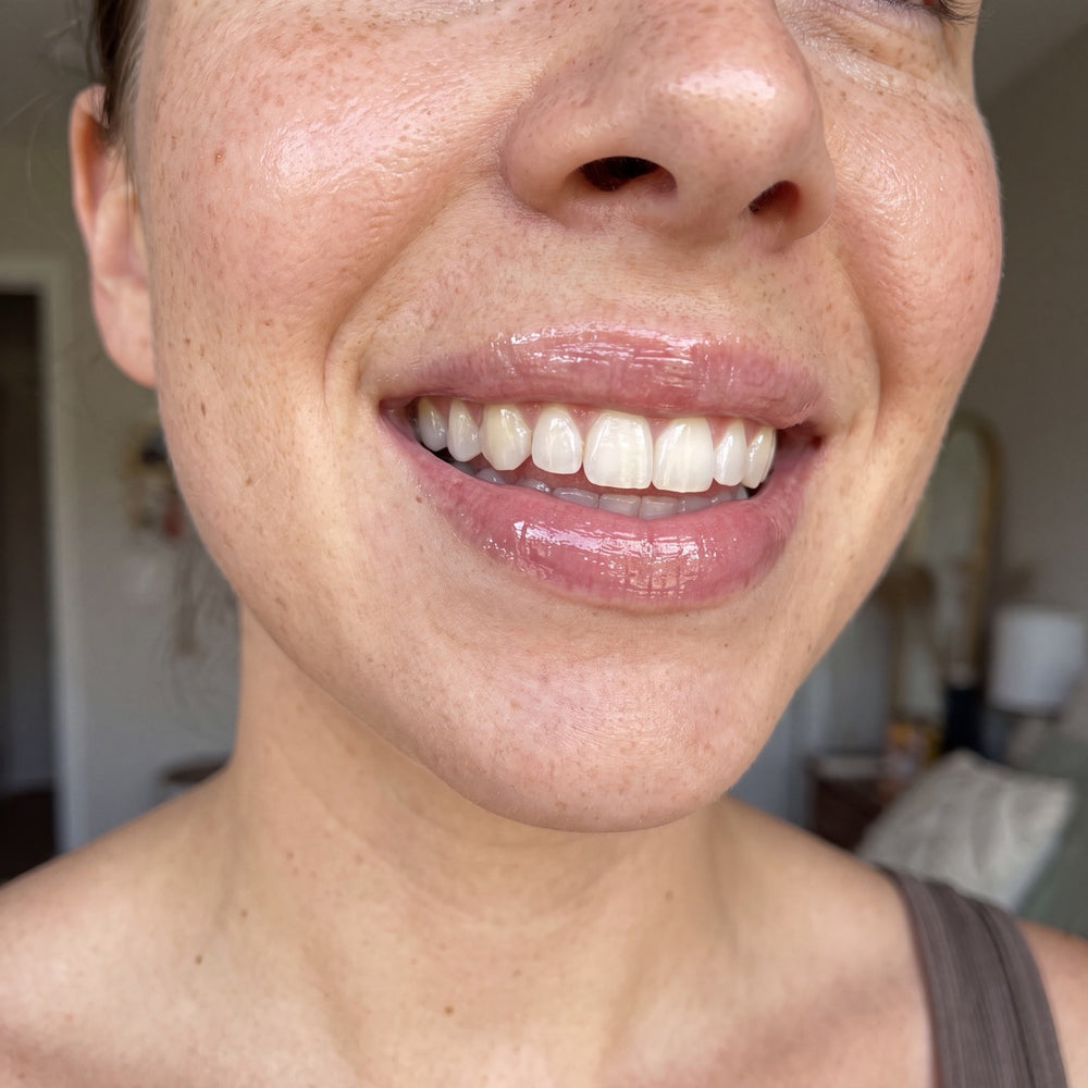 Natural fuller lips without botox!