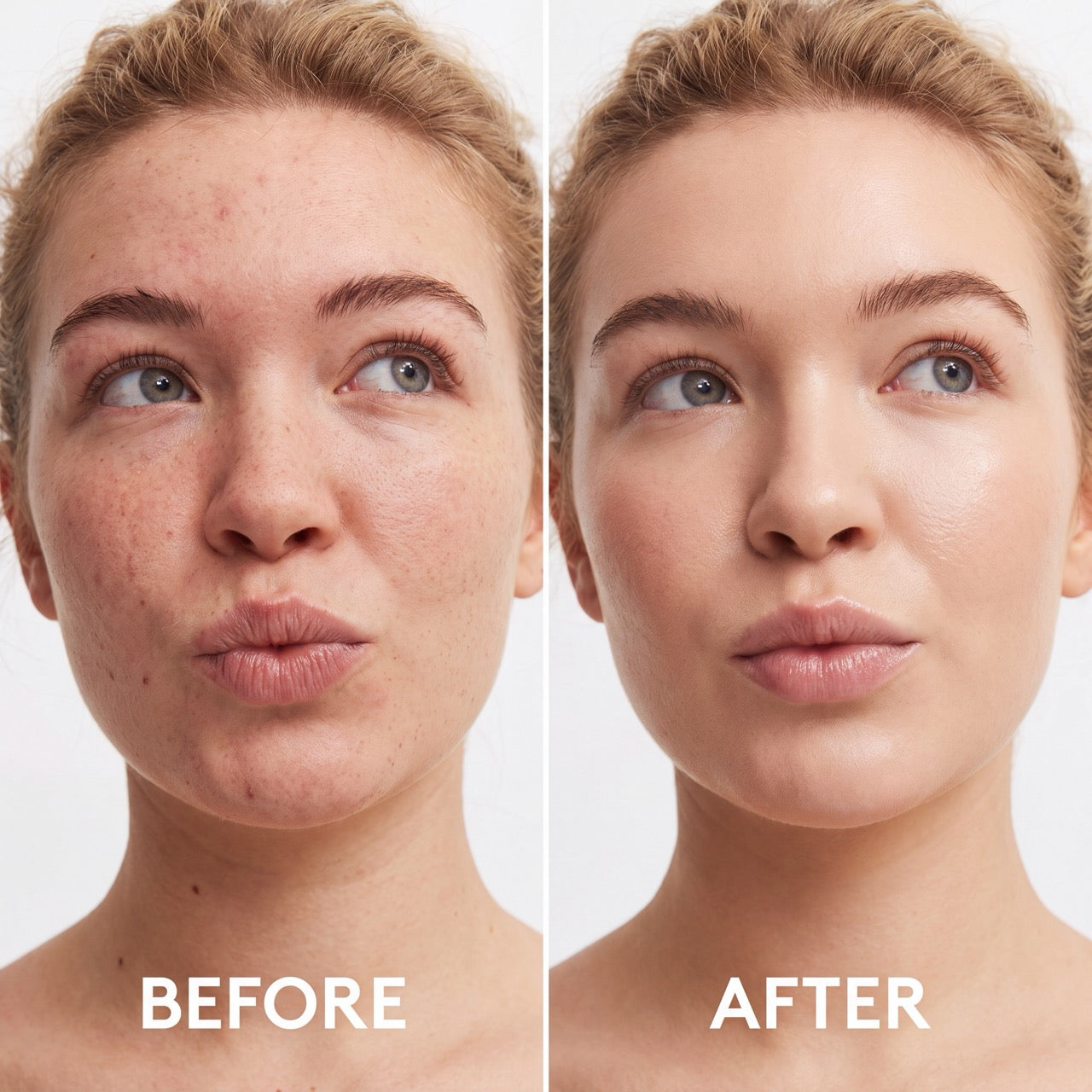 All tone Foundation