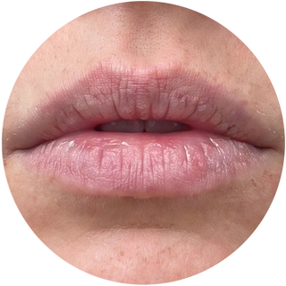 Apply it to your lips
